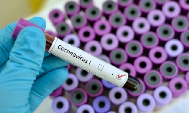 انجام اولین آزمایش‌های انسانی درمان آنتی‌بادی  COVID-19در جهان با همکاری ونکوور
